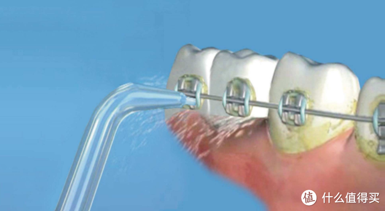 为什么牙医不推荐冲牙器？三大风险坏处曝光，要小心！