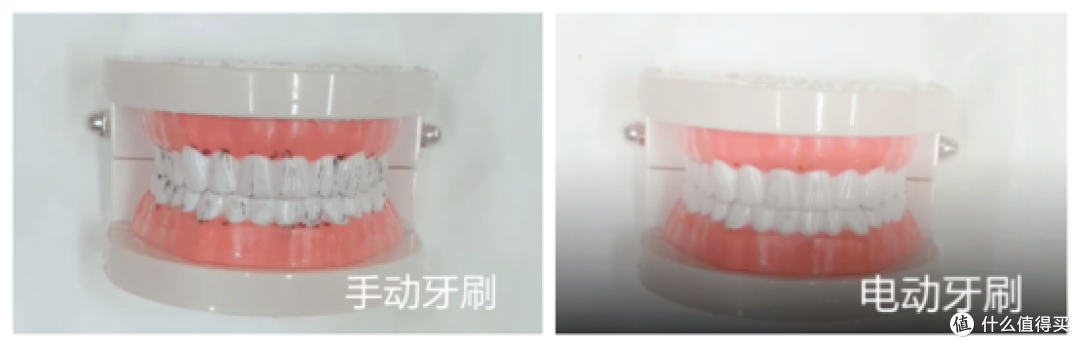 电动牙刷是智商税还是真有用?三大弊端槽点注意避雷!