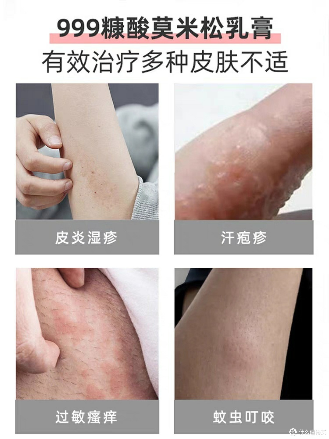 秋冬也要远离湿疹,人人有责。