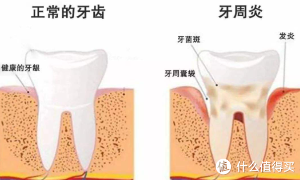 冲牙器哪款好？五大高口碑热门冲牙器推荐！