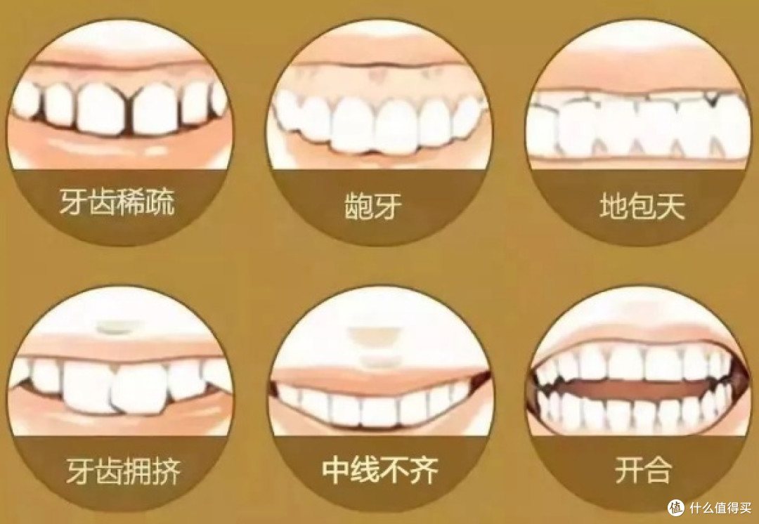 热门冲牙器推荐测评PK：扉乐、洁碧、松下、素士、米家等年度品牌榜