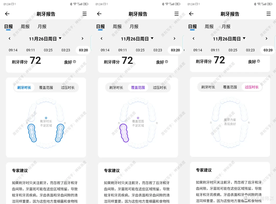 智能洁齿,笑容常伴-usmile笑容加F10数字牙刷使用体验分享