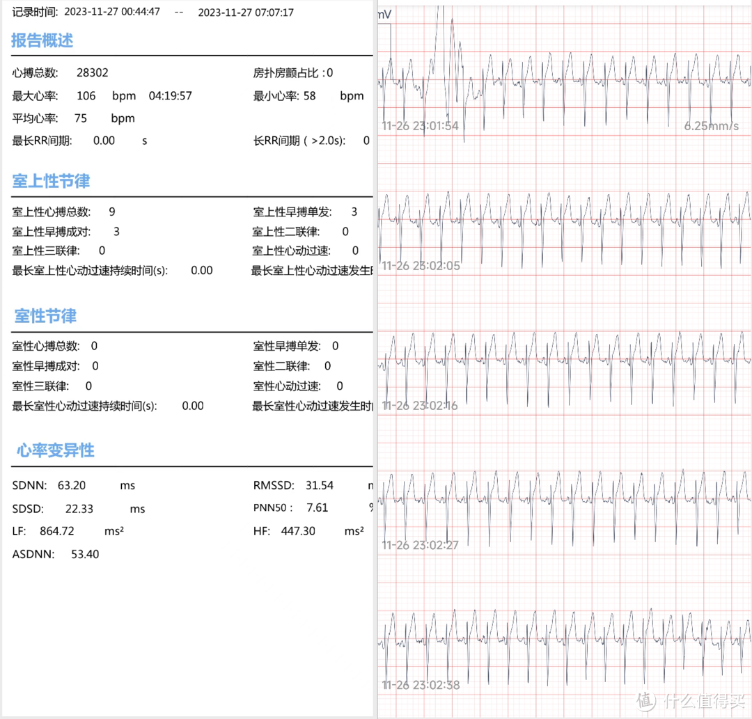 24小时全天候护心——乐普心安宝ER01心电记录仪