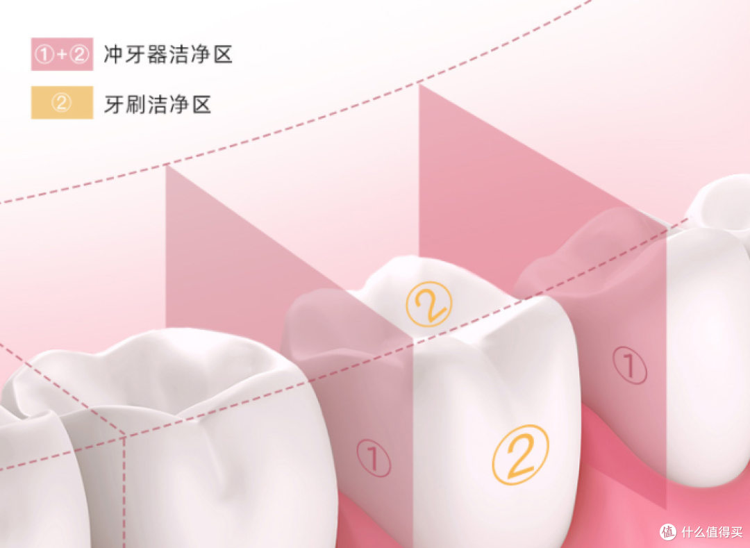 牙医是否让用冲牙器?爆料四大内幕隐患!