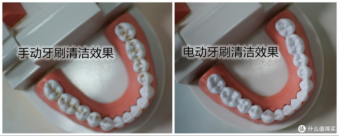 电动牙刷适合几岁以上的孩子?曝光三大坏处缺点