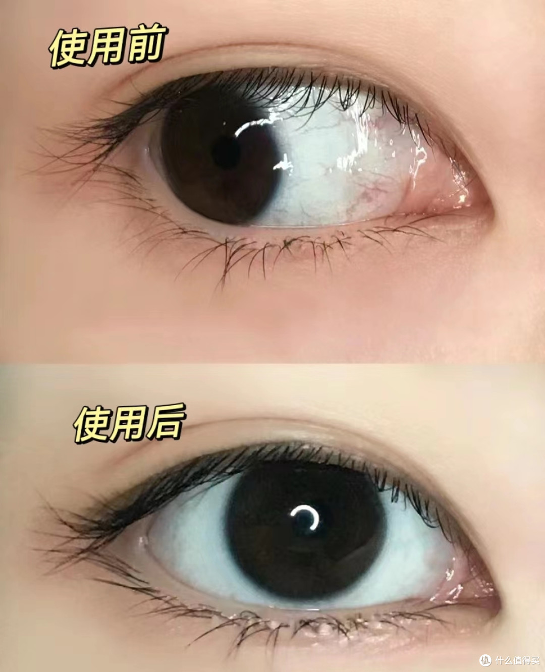 眼睛看东西很是模糊、干痒难受,请问现在做些什么好呢?