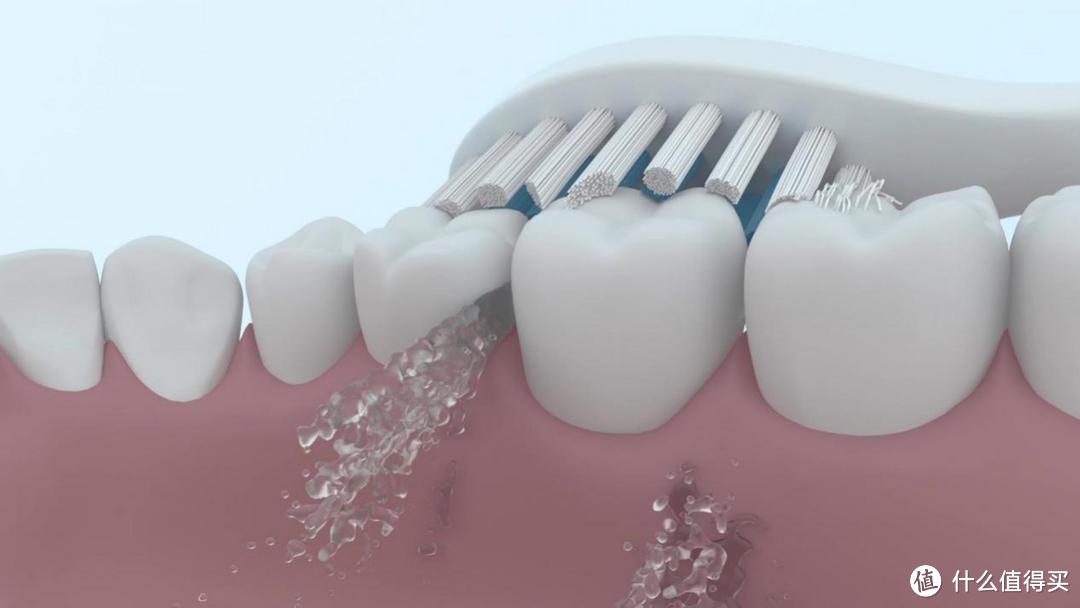 电动牙刷的优缺点总结：提醒规避三大危险害处！