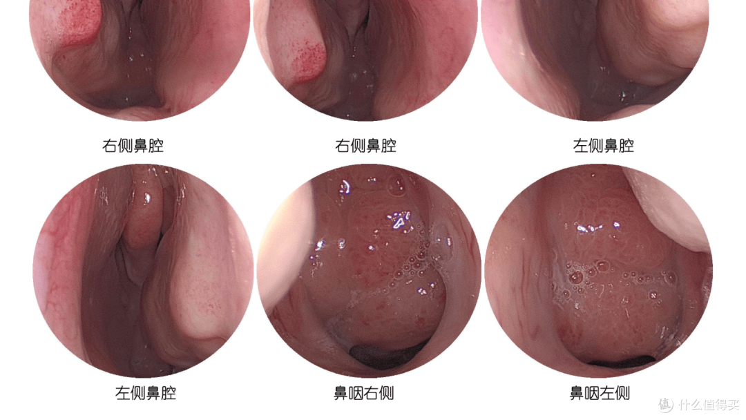 近万字整理|武汉协和医院儿童腺样体手术指南·入院篇