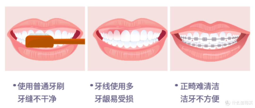 医生建议使用冲牙器吗？揭露三大风险骗局！