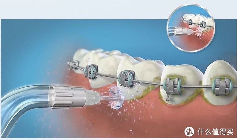 十大冲牙器品牌：十款专业性高品牌，专家亲测力荐