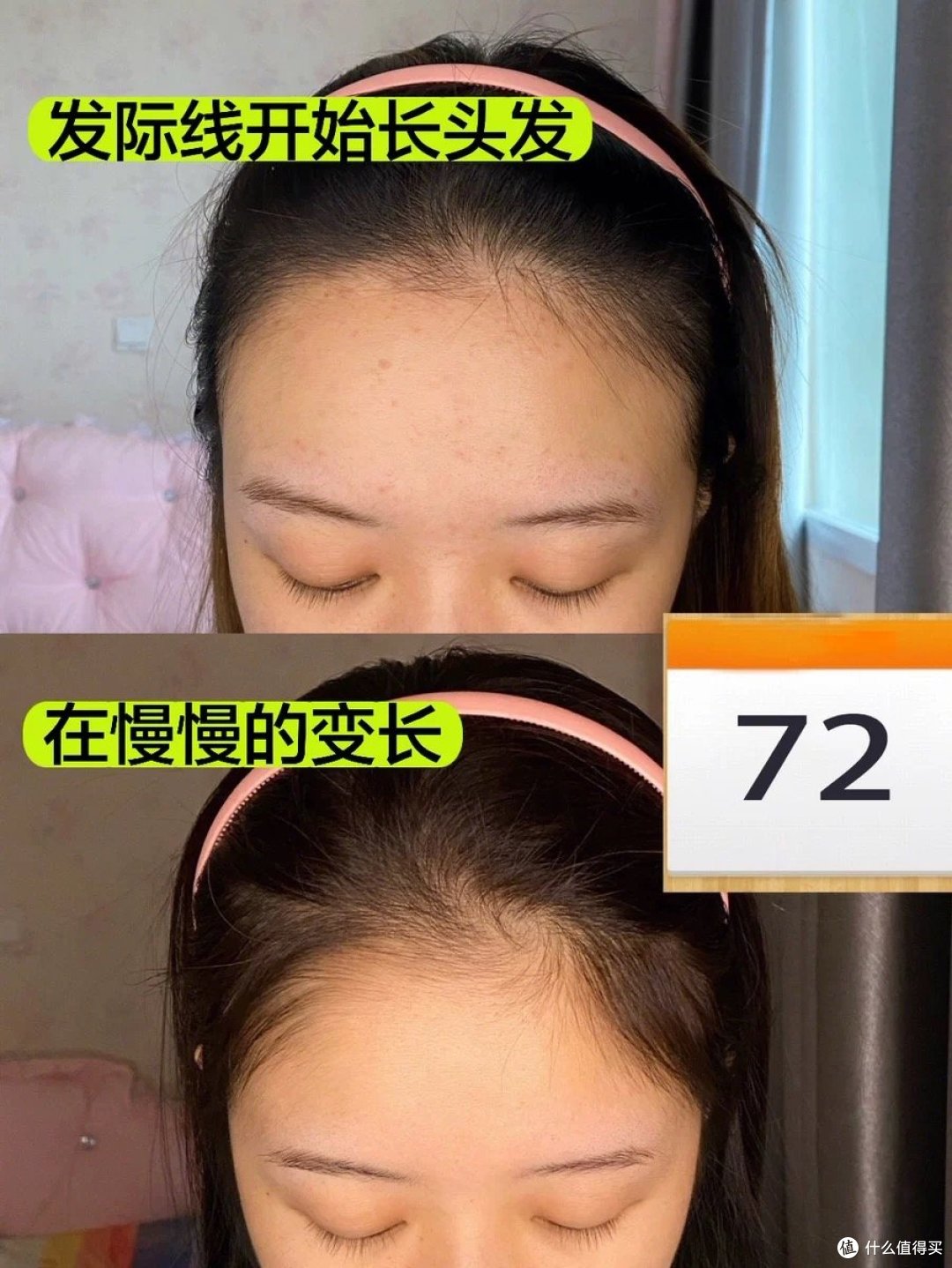 哪款牌子洗发水防脱好?发根强化,告别秀发稀疏!