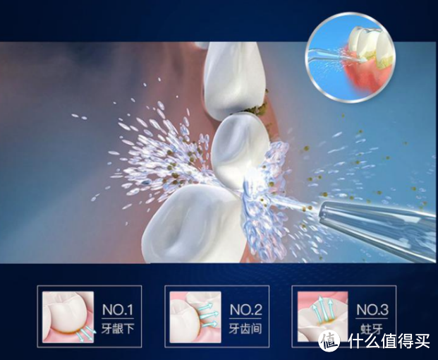 冲牙器怎么挑选?爆料四大坏处黑幕!