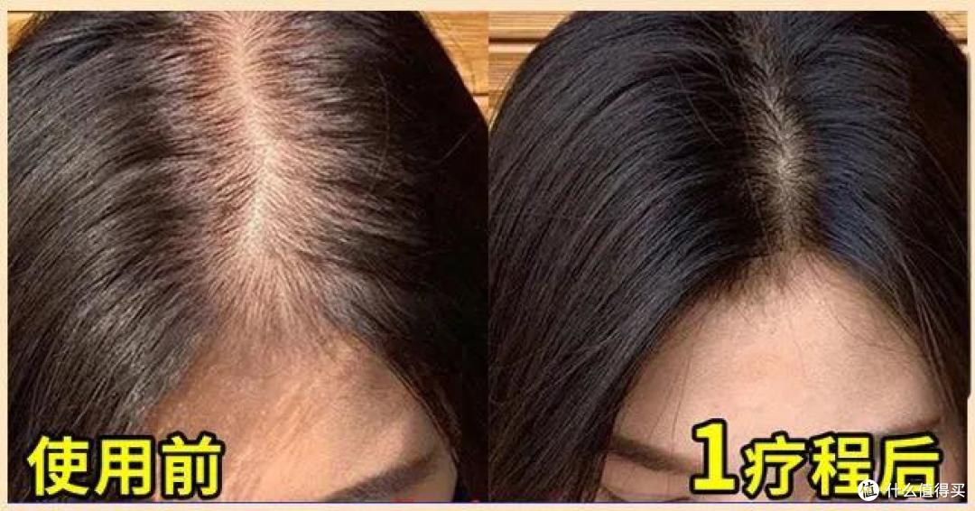 什么牌孑的洗发水可以防脱生发?领先科技,打造坚固秀发防线!