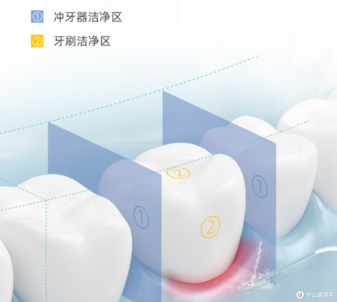 牙齿敏感可以用冲牙器吗？揭秘三大弊端陷阱！