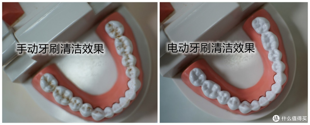 使用电动牙刷有必要吗?三大危害弊病要当心!