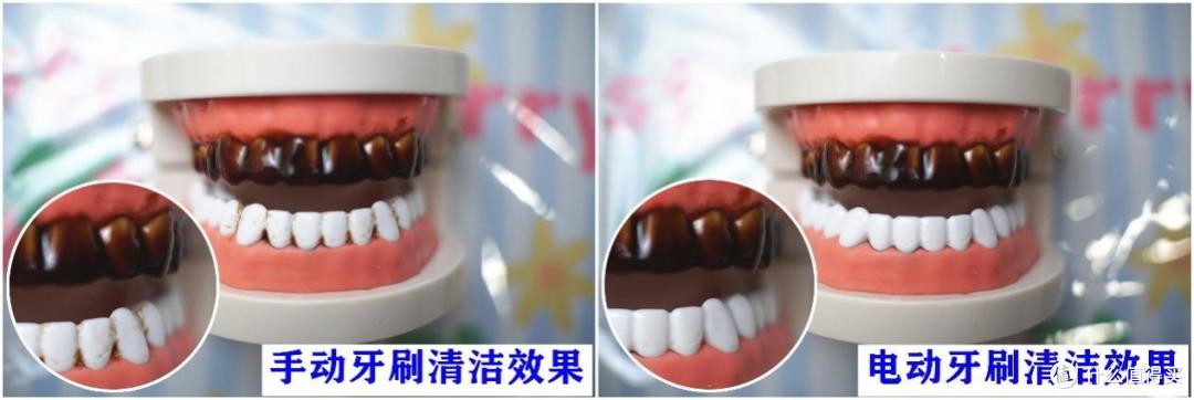 电动牙刷会对牙齿造成伤害吗？起底三大害处智商税！