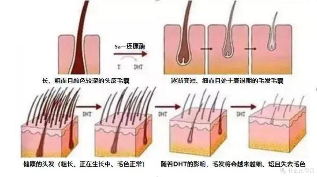 【脱发必看】2023高效防脱攻略!医学硕士教你4招,3个月改善头顶稀疏、养出浓密发量!