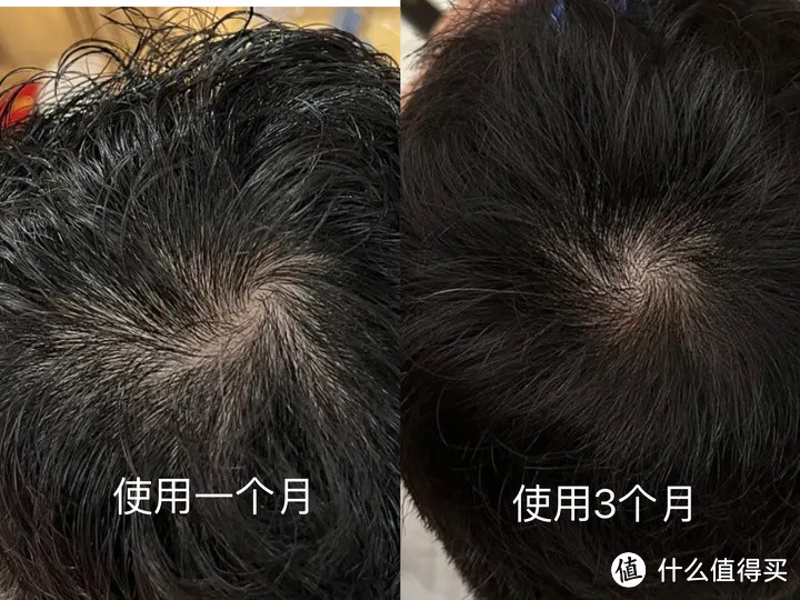 头顶发缝使用前后对比