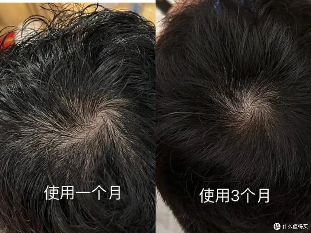 头顶发缝使用前后对比