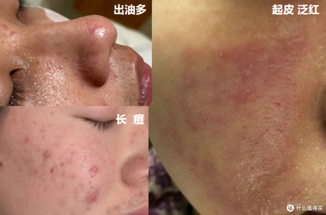 用错水乳，毁脸比护肤更容易