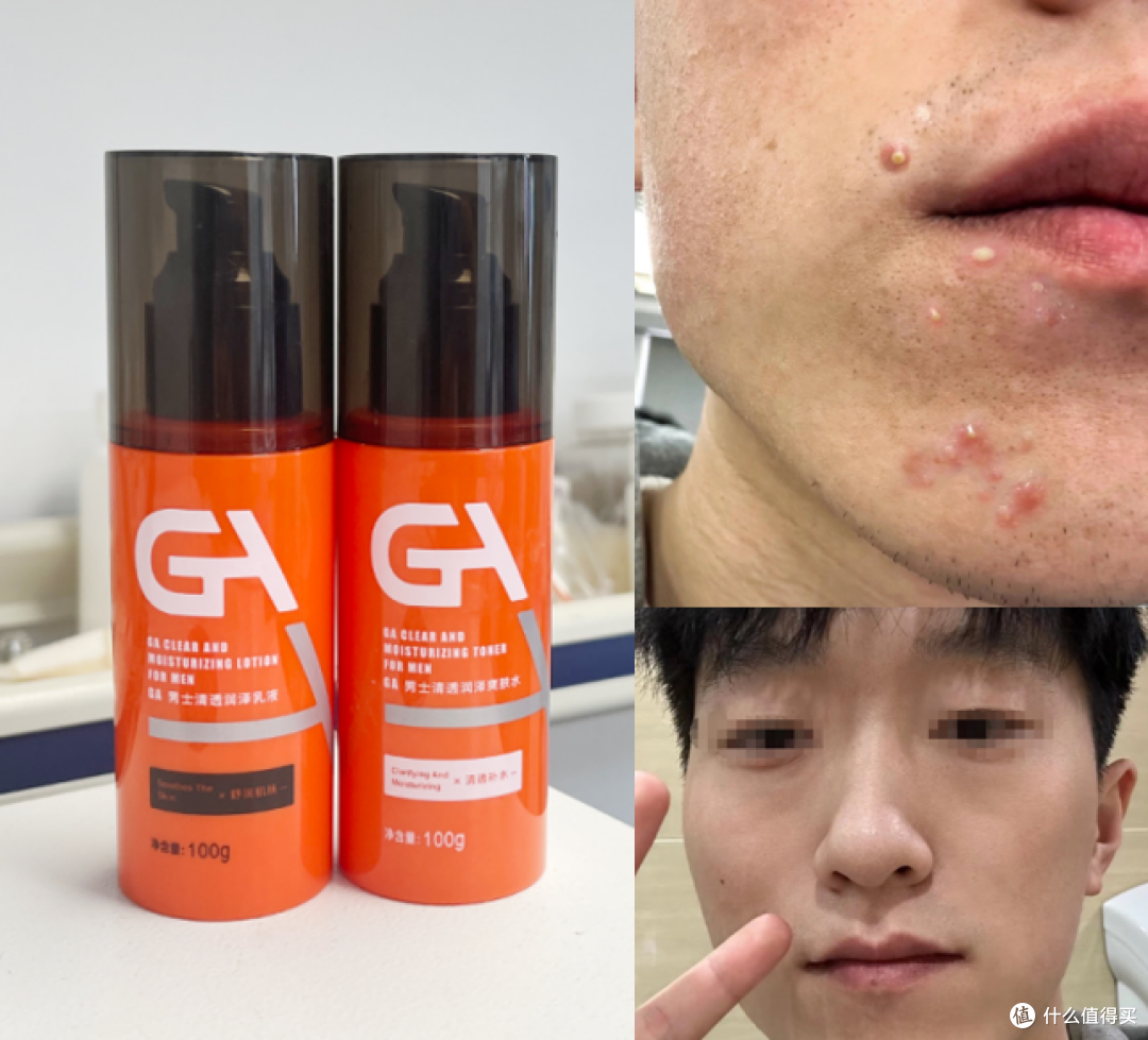 2024男士水乳测评推荐丨哪些男士水乳性价比高又好用？这8款【控油 保湿 祛痘 美白】的男士水乳好用到爆