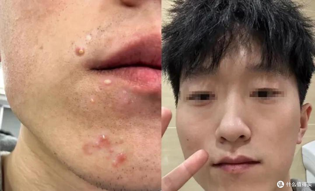 2024男士水乳测评推荐丨哪些男士水乳性价比高又好用？这8款【控油 保湿 祛痘 美白】的男士水乳好用到爆