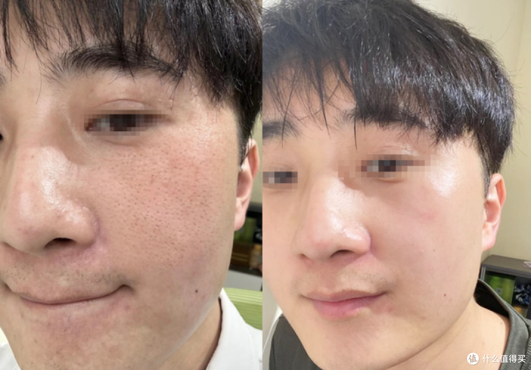 我女朋友说我皮肤像是回到了高中时代