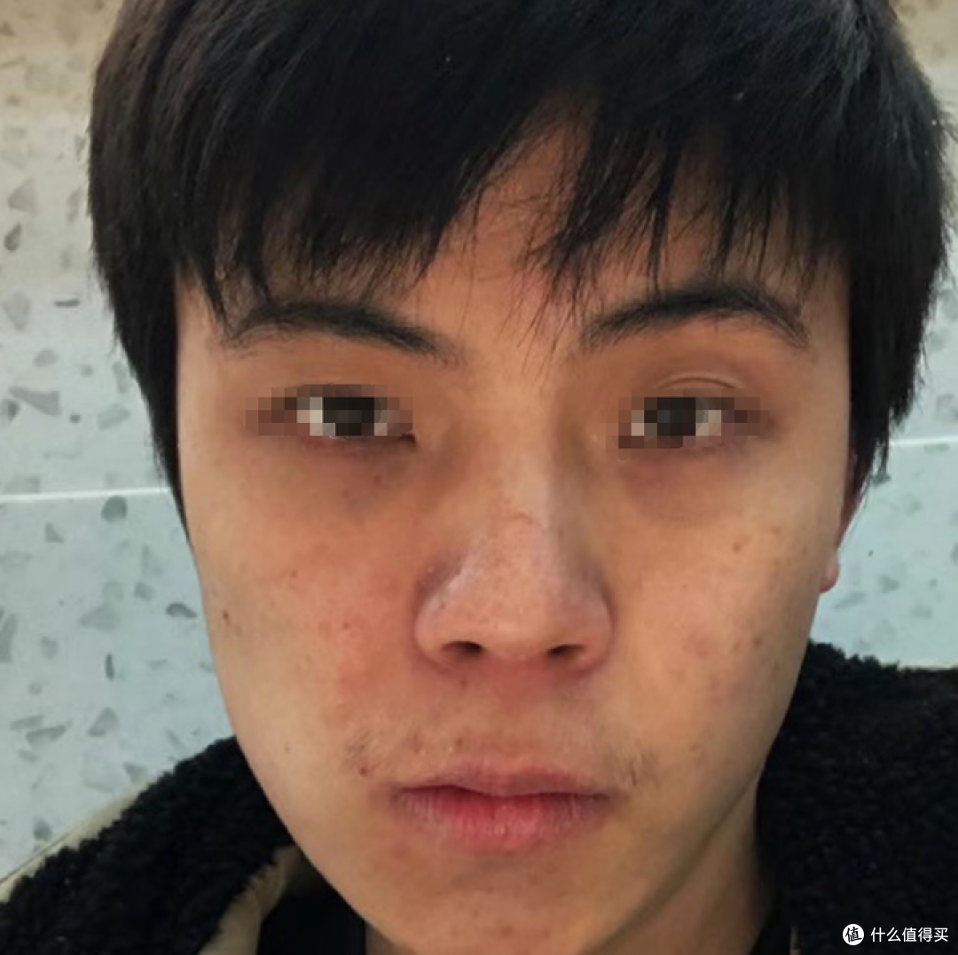 熬夜太糟蹋皮肤了