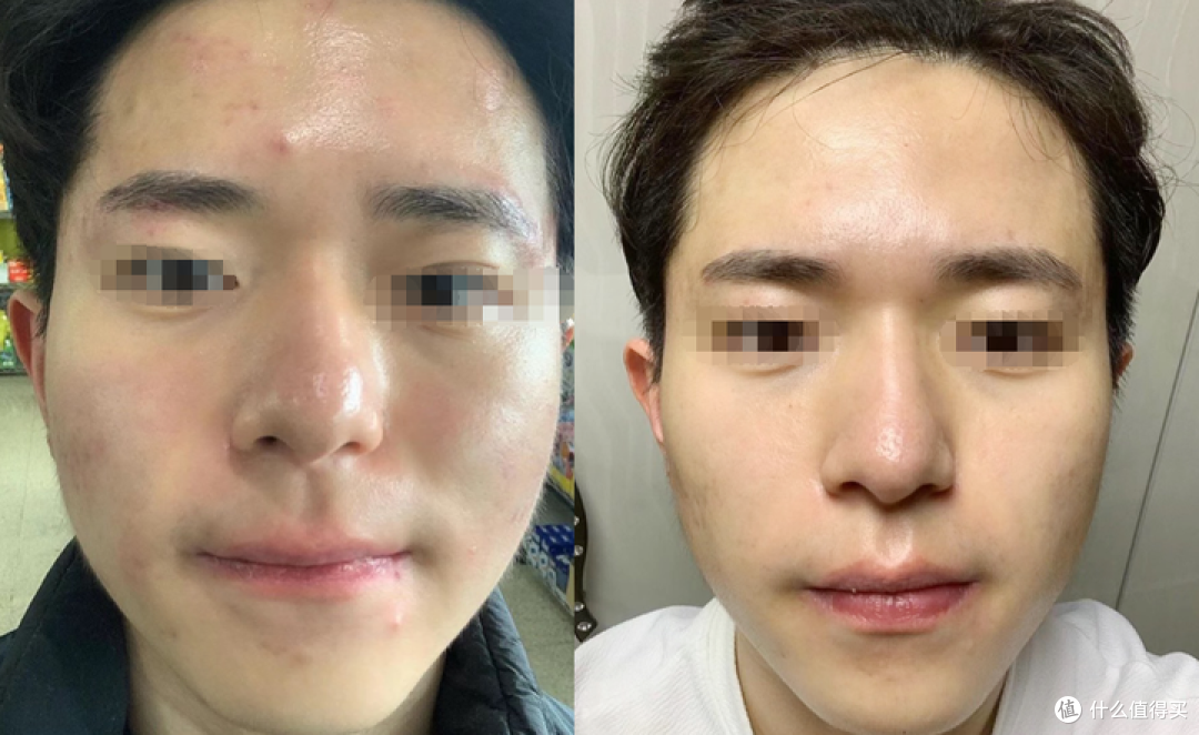 2024男士水乳测评推荐丨哪些男士水乳性价比高又好用？这8款【控油 保湿 祛痘 美白】的男士水乳好用到爆