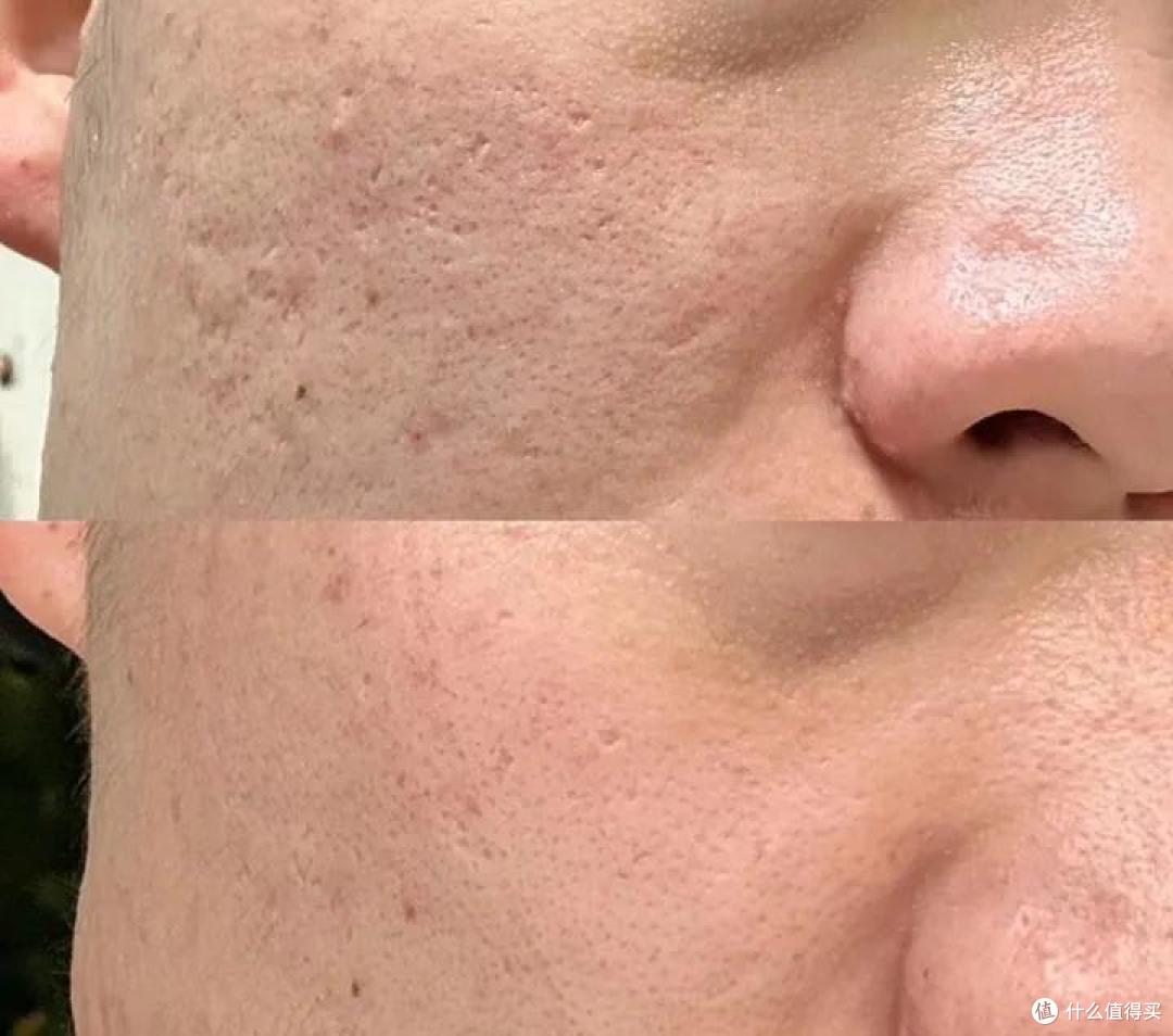 2024男士水乳测评推荐丨哪些男士水乳性价比高又好用？这8款【控油 保湿 祛痘 美白】的男士水乳好用到爆