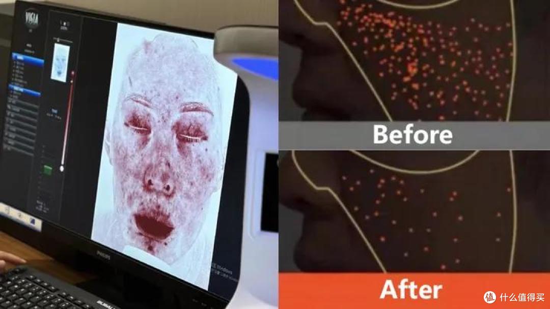 橙色点越密集，油脂越多