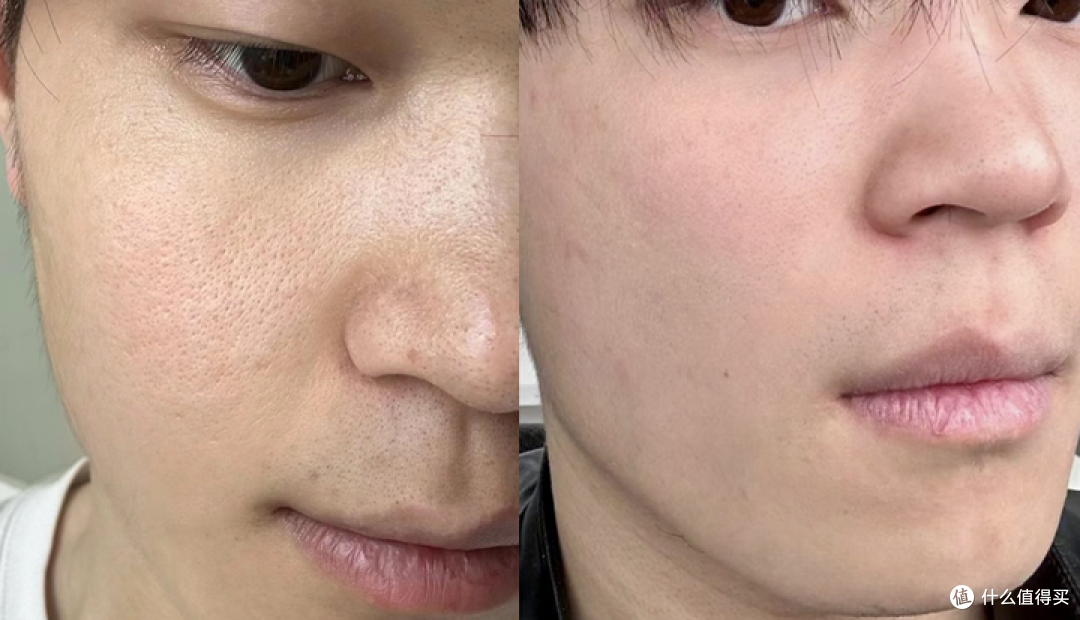 2024男士面霜段位榜推荐 【配方师揭秘】秋冬男生脸上爆皮、泛红、暗沉、长痘，选这9款男士面霜就够了！