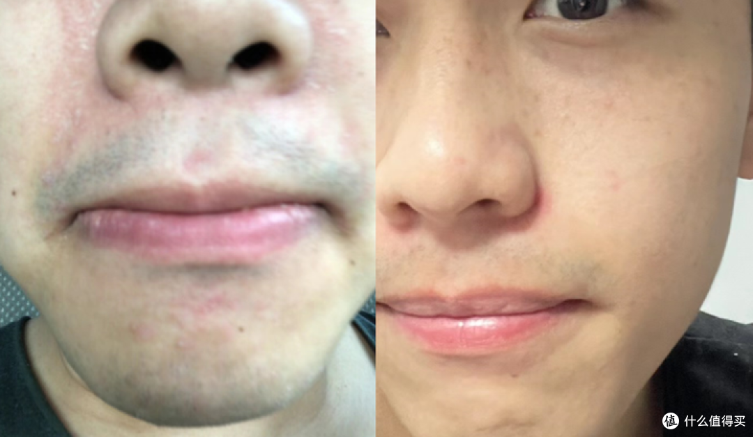 2024男士面霜段位榜推荐 【配方师揭秘】秋冬男生脸上爆皮、泛红、暗沉、长痘，选这9款男士面霜就够了！