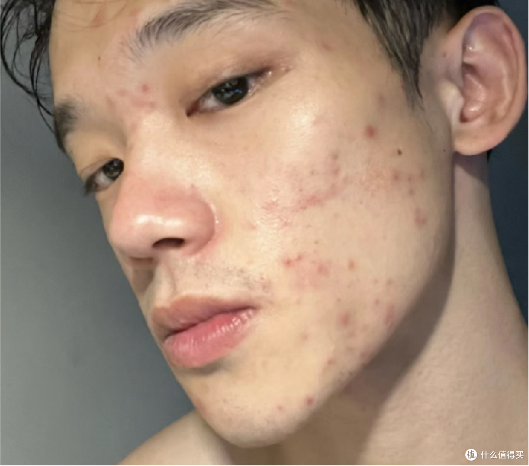 2024男士面霜段位榜推荐 【配方师揭秘】秋冬男生脸上爆皮、泛红、暗沉、长痘，选这9款男士面霜就够了！