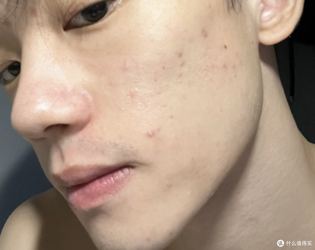 2024男士面霜段位榜推荐 【配方师揭秘】秋冬男生脸上爆皮、泛红、暗沉、长痘，选这9款男士面霜就够了！