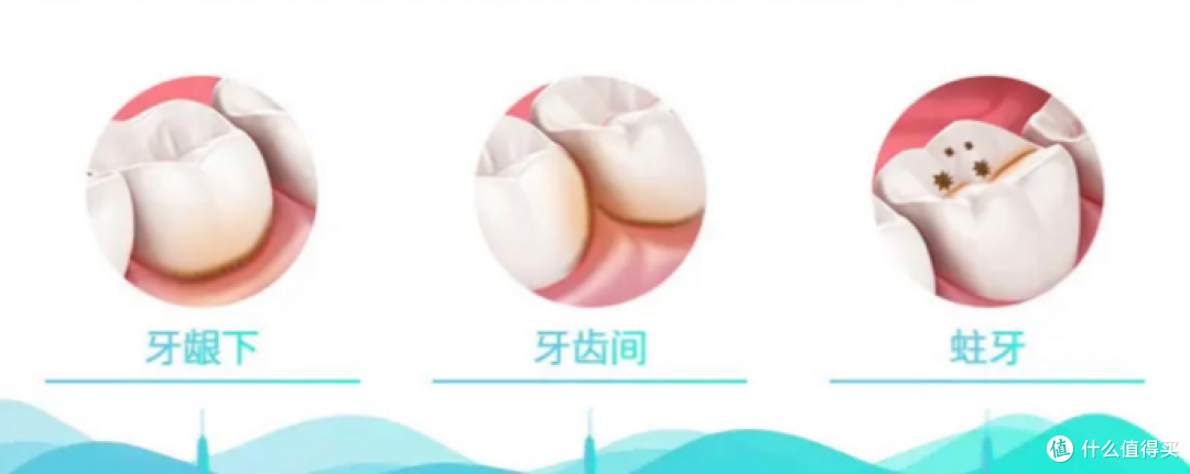 整牙可以用冲牙器吗?牢记三大槽点骗局不踩雷!