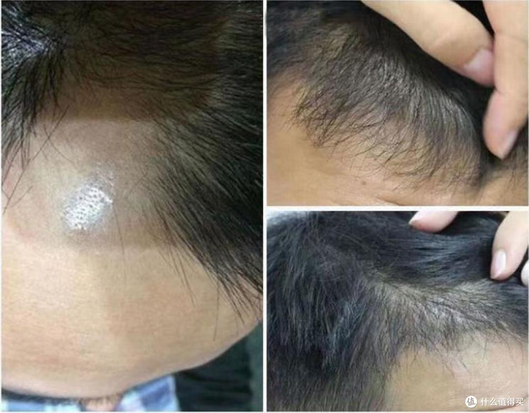 头发油脱发用什么洗发水比较好？持久保护，守护你的完美发质！