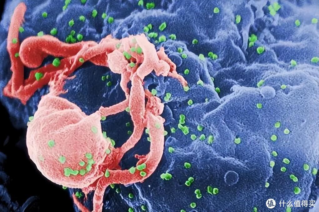 全球第 5 位艾滋病治愈者出现，艾滋病患者有救了吗？
