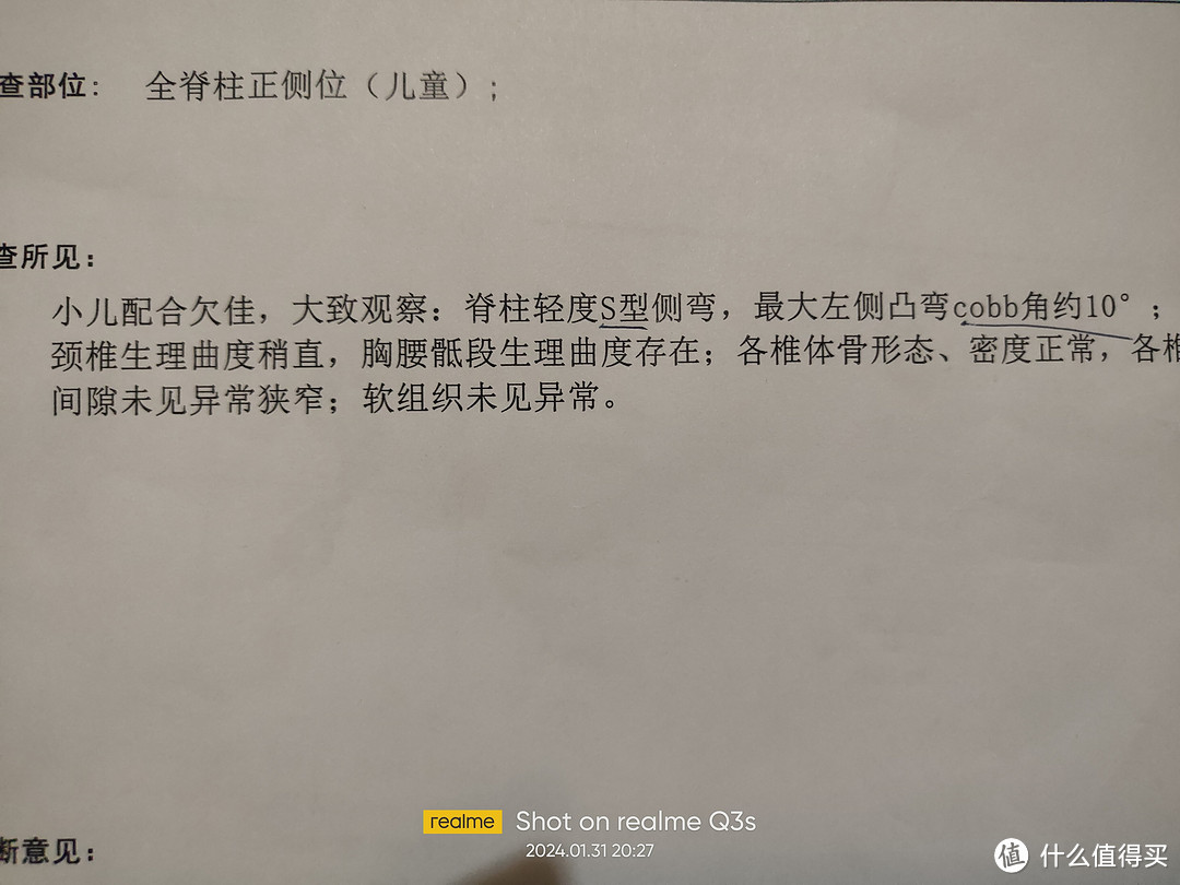 为了孩子的脊柱侧弯问题，真的是想尽各种办法了