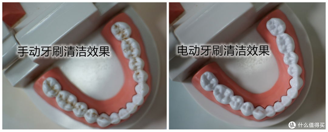 儿童电动牙刷伤牙吗?宝妈必读三大弊病副作用!