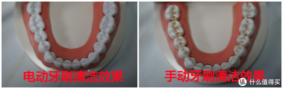 牙医建议使用电动牙刷吗？详解扫振、旋转、声波式缺点