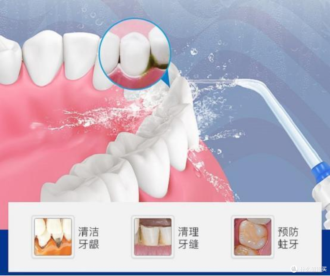 冲牙器对牙齿有好处吗?警告三大圈套黑料!