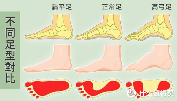 困扰很多跑者的足底筋膜炎，我是怎么对付它的