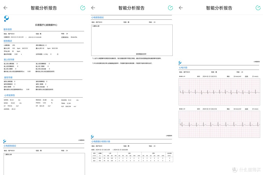 专业的心电记录仪跟智能手环or手表有什么不同？为何我建议你要选择专业心电记录仪？