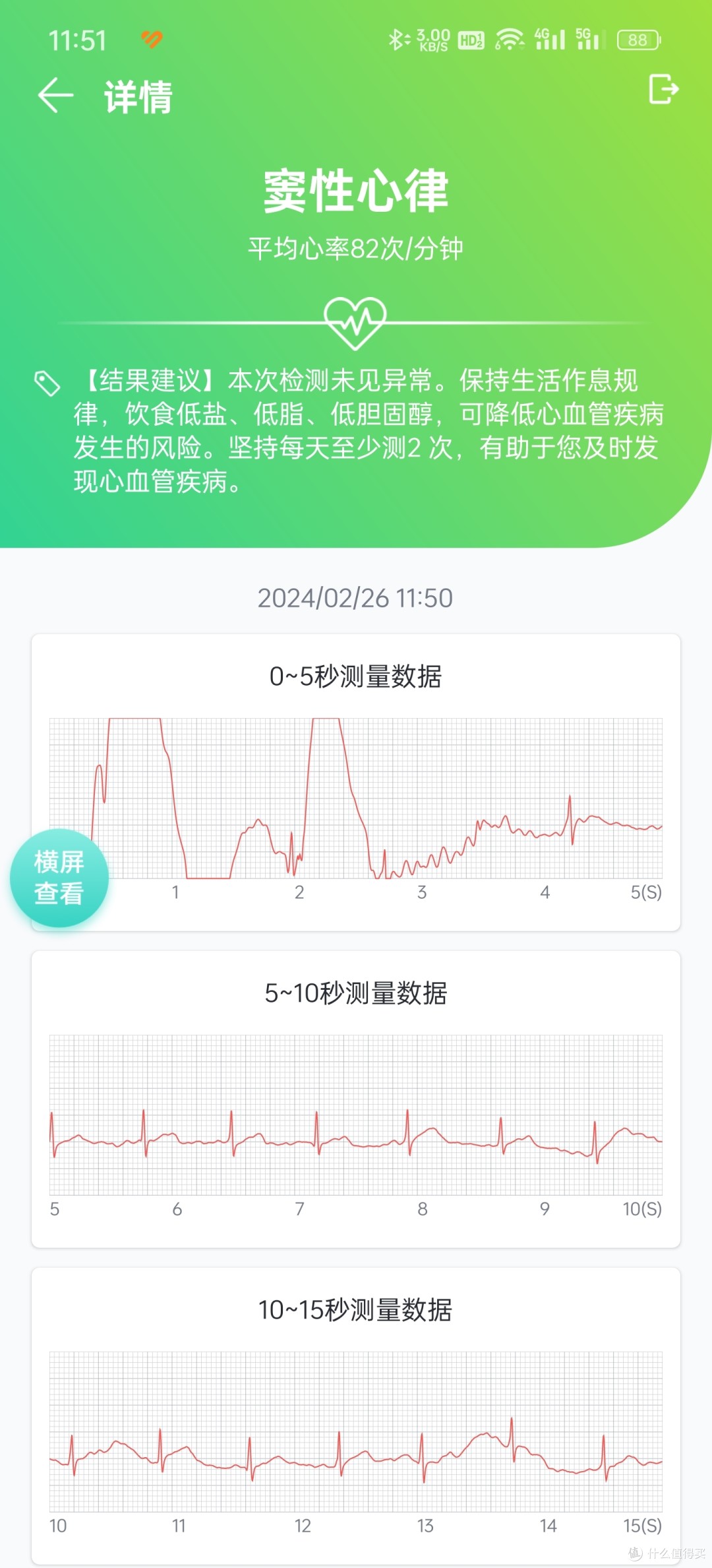 专业的心电记录仪跟智能手环or手表有什么不同？为何我建议你要选择专业心电记录仪？