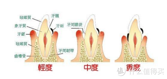 电动牙刷的危害副作用科普：披露三大智商税隐患