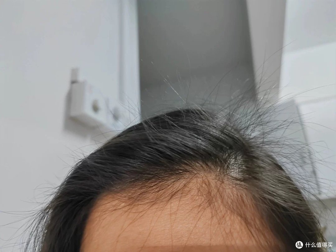 家人们谁懂啊,终于长小头发了