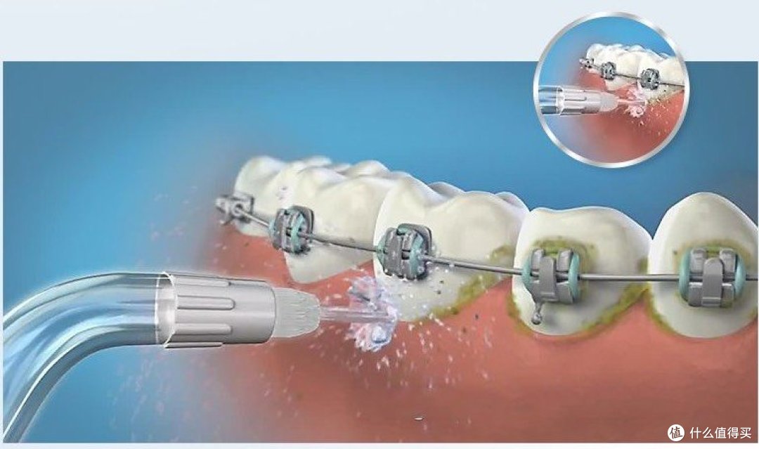 冲牙器排行榜前十名：十大性能优越品牌，2024年专家优选