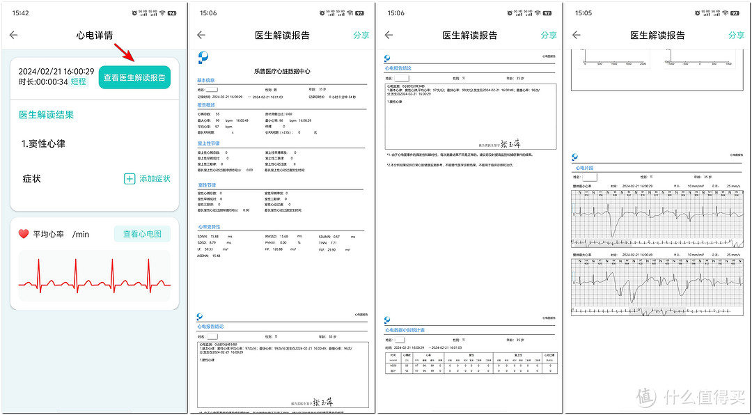 阳康后常出现心悸心慌？家用心电仪——24小时的健康守护神