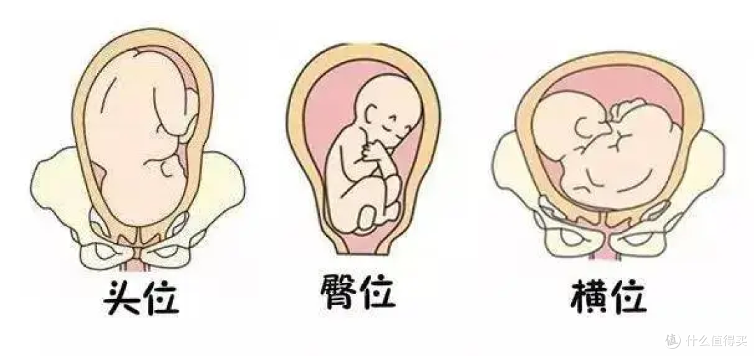 胎位不正怎么办?先别急,不想胎位不正,孕妈请多做3+4件事